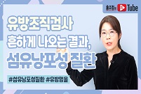 유방조직검사 하면 흔히 나오는 결과, 섬유낭포성 질환!